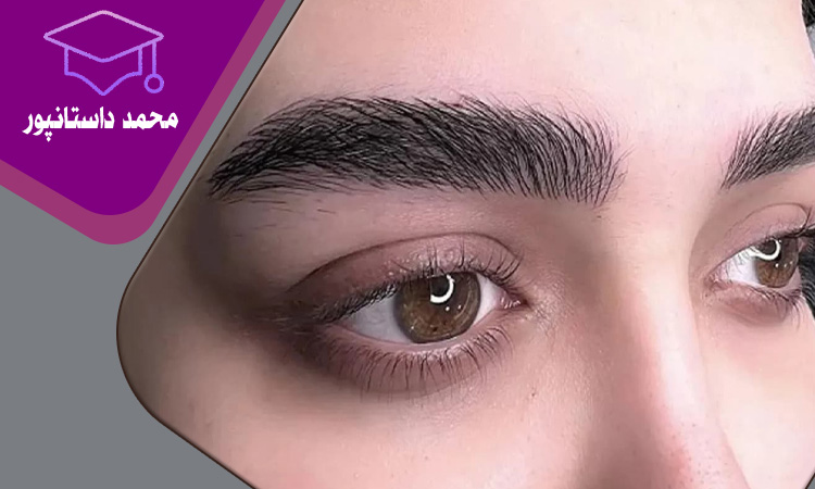 میکروبلیدینگ و فیبروز ابرو
